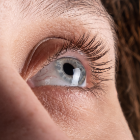 9 Treatment Options for a Person with Keratoconus