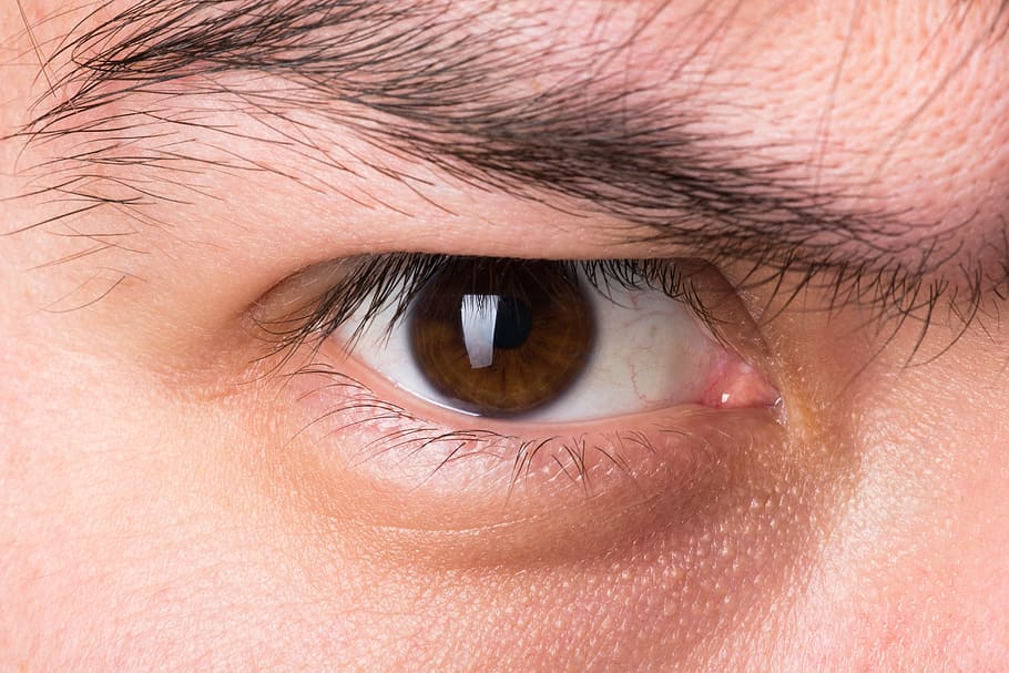 What are Eyelid Abnormalities?